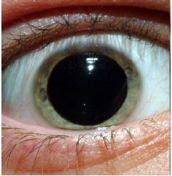 eyes on diazepam effect